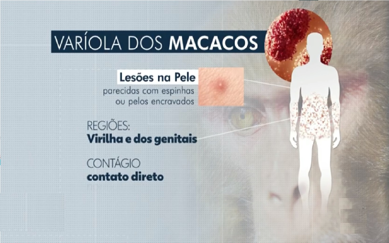 http://surgeaki.com - Varíola do Macaco | Contágio